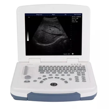 2023, продажбите на Едро CE, пълно цифрово ултразвуково сканиране, медицински преносим ултразвуков апарат за използване в болници, медицински